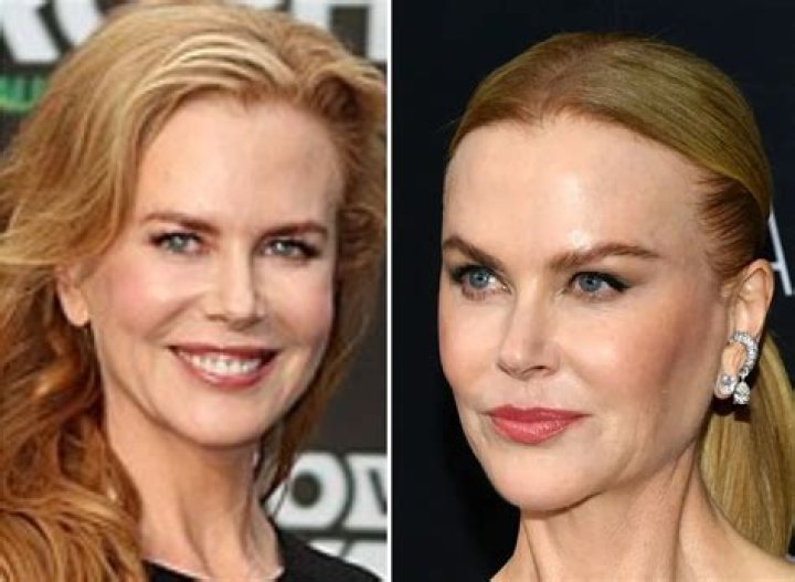 Fans accuse Nicole Kidman of changing face: 'You don't look you'