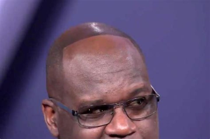 Shaq reveals receding hairline after losing bet to Dwyane Wade