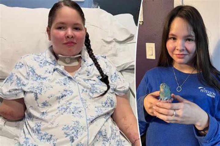 Teen who was crushed by forklift opens up about amputation